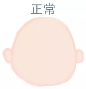 宝宝圆头好还是扁头好？这些奥秘很多爸妈都不知道5.webp.jpg