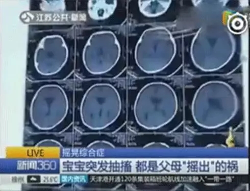 多名婴儿脑出血，家长一个不经意的动作竟然对宝宝伤害这么大1.webp.jpg